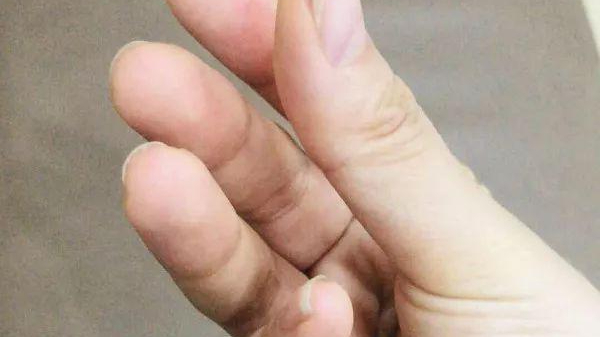 21岁女生被送医急救 手抽筋得像鸡爪 21岁女生被送医急救 手抽筋得像鸡爪