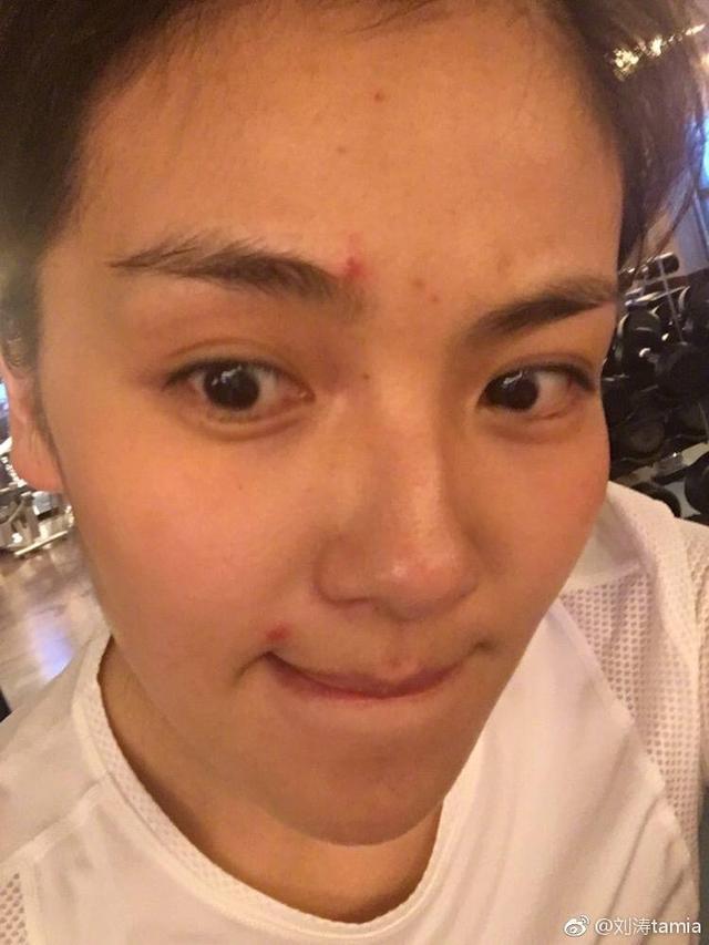 刘涛晒痘暴露女明星伪素颜照,蒋欣因为长痘暴躁成杨迪脸