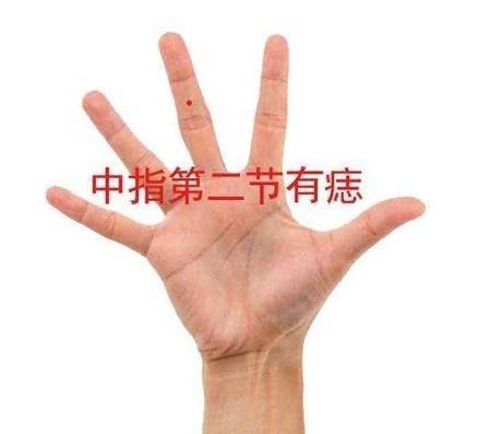 手指有痣究竟好不好,长在手指上又有什么寓意
