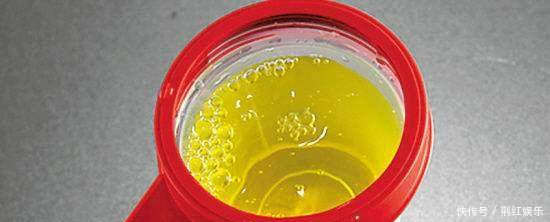 尿色很深 早上第一泡尿,一般是比较重要的,能够传达出身体的一些信息.