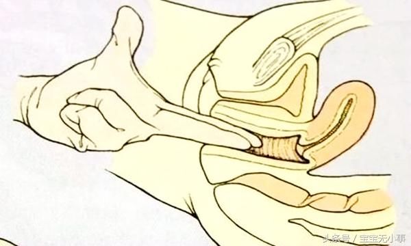 生孩子宫口开到几指最疼?这位宝妈的回答让孕