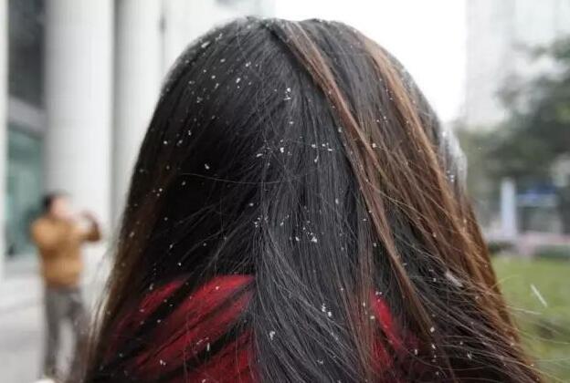 头发油腻的人,螨虫变多,会出现3个损害,收下3个除螨控油妙招