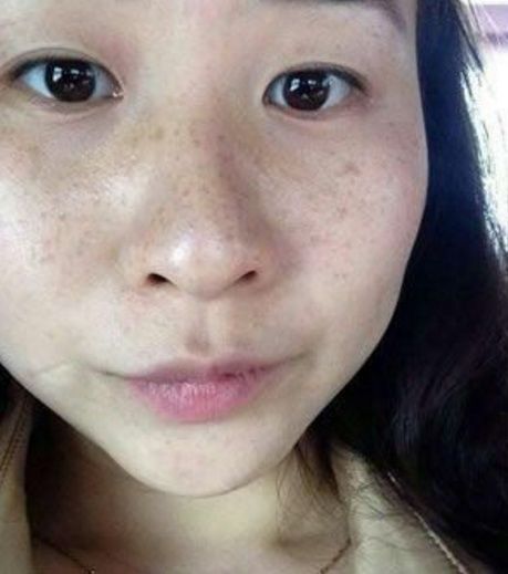 小小牙膏加一物,祛斑效果胜过万元整容,三天皮