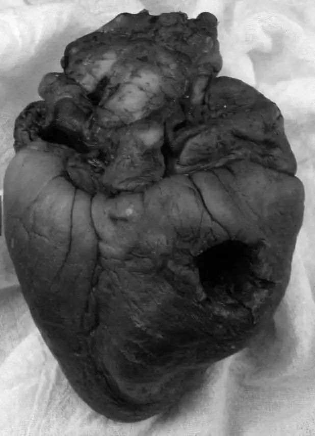 15张很恐怖的历史老照片,但背后的故事更吓人