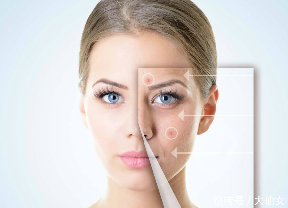 激素脸又红又痒又肿了,该怎么修复好?