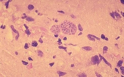 价值千金!长寿的人都有这7个习惯