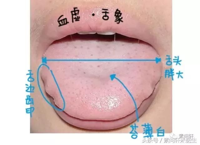 人生路上你是否已气血不足?符合其中3点就一
