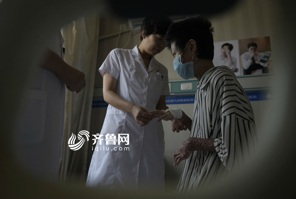主治医生李娅表示,由于刘振身上已经没有多余的好皮进行移植,只能通过人工造皮来帮助她进行身体恢复。