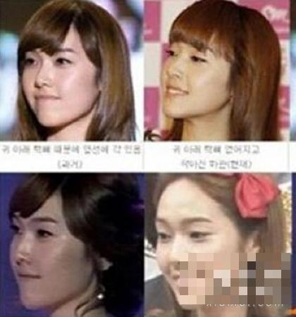 少女时代成员整容前后对比郑秀妍允儿旧照吓人