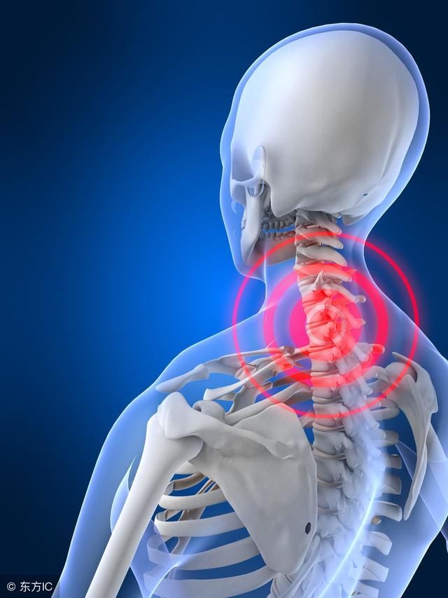 颈椎病引起头晕恶心、手麻?老专家的1个方子