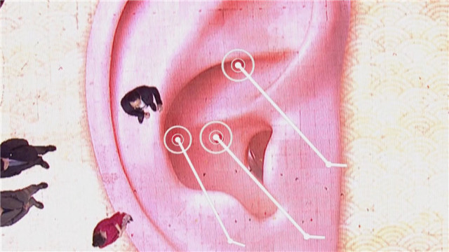 《养生堂》20180126百年程氏养生经