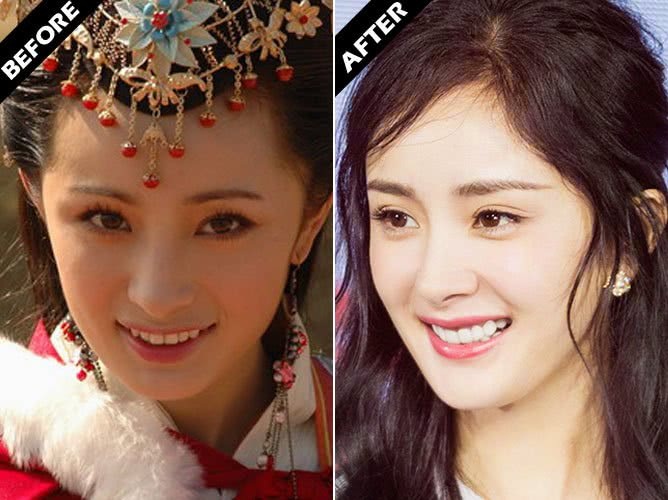女星整牙改变命运?只有她整牙之后变丑了!
