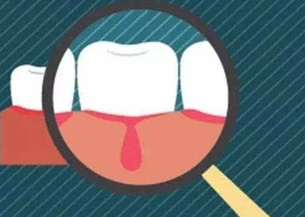 男朋友患牙周炎传染给女朋友?医护人员:接吻