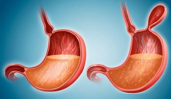 患有慢性胃炎的人越来越多,你知道如何治疗胃