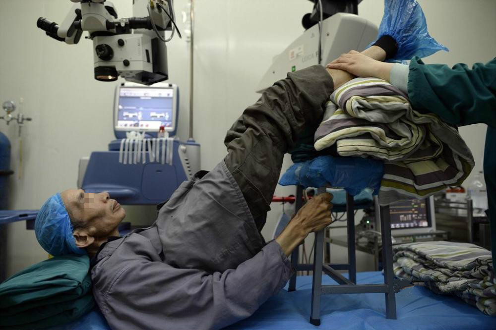 老人驼背90度手术台为他垫1米高凳