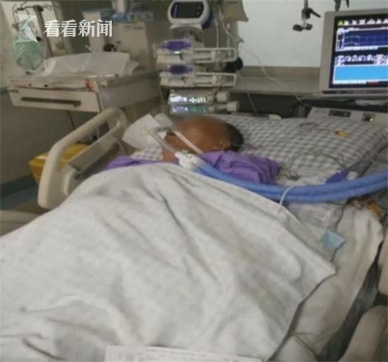 男子喝变质牛奶后晕倒送医 肾脏衰竭昏迷数日