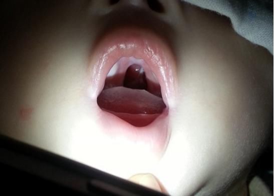 2岁5个月的宝宝不会说话,检查结果让妈妈后悔