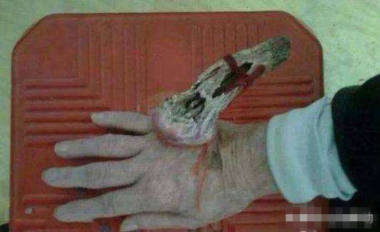 老人手臂长出一个犄角, 路人好奇观察, 结果却吓