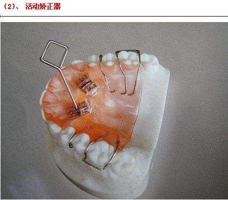 baby、杨幂整牙后变美,究竟有没有那么神奇?