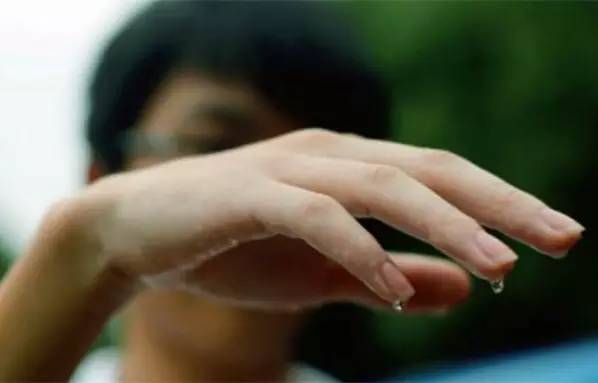 手脚心多汗:湿热重