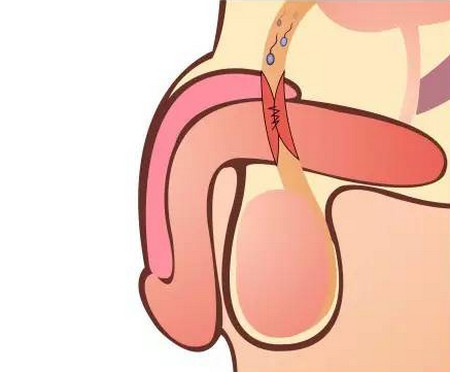 前列腺在男人生育過程中,究竟是怎樣的重要存在?
