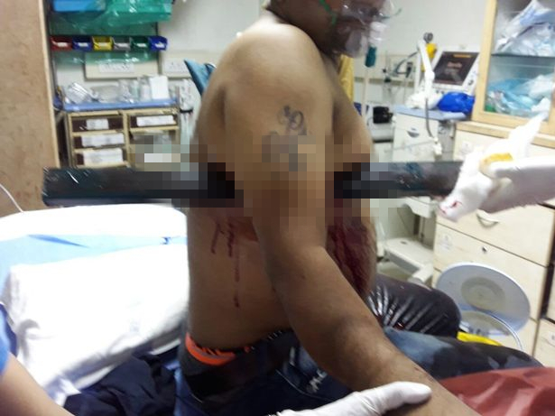 男子驾车打瞌睡 被铁柱横穿躯干