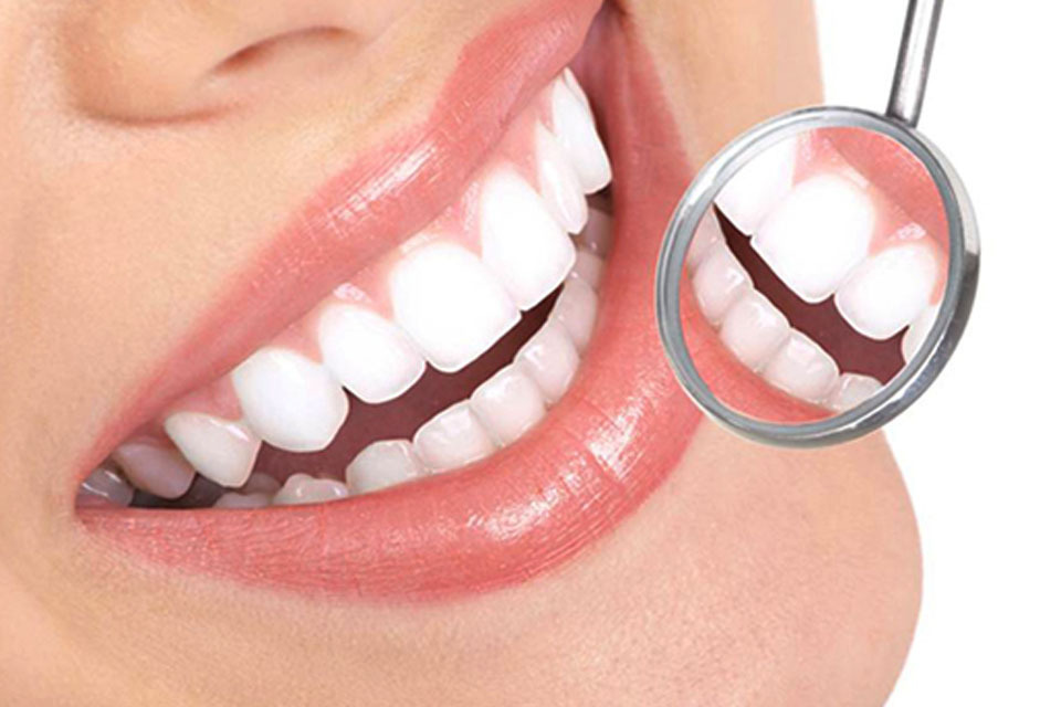 洗牙对牙齿好不好?了解这些有必要