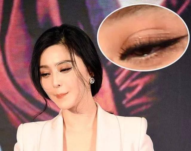 让戚薇承认整容的双眼皮贴,到底什么来头?