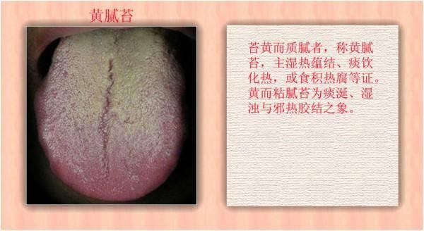 怎么判断孩子是积食性咳嗽?有哪些表现?宝妈