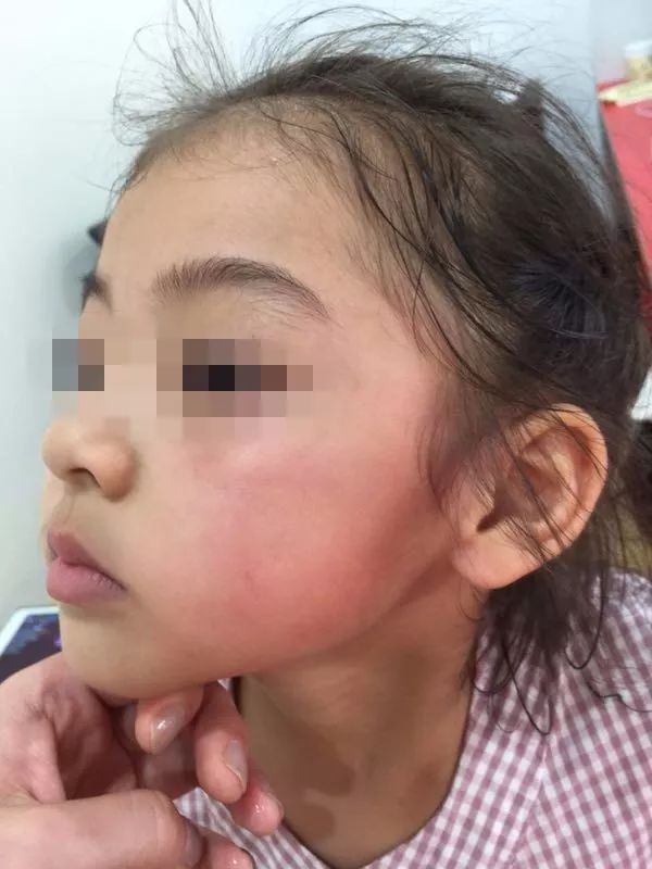 家长护犊掌掴对方小孩致脸肿被拘留 监控令人揪心