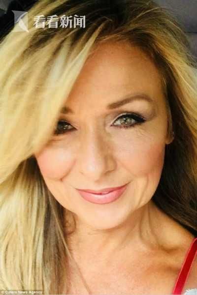 女子25年不卸睫毛膏 眼皮下布满骇人颗粒险失