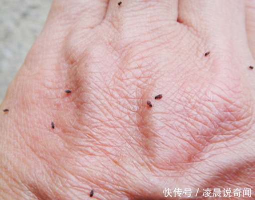 男子发现手脚上全是小黑点,几巴掌将其消灭,几分钟