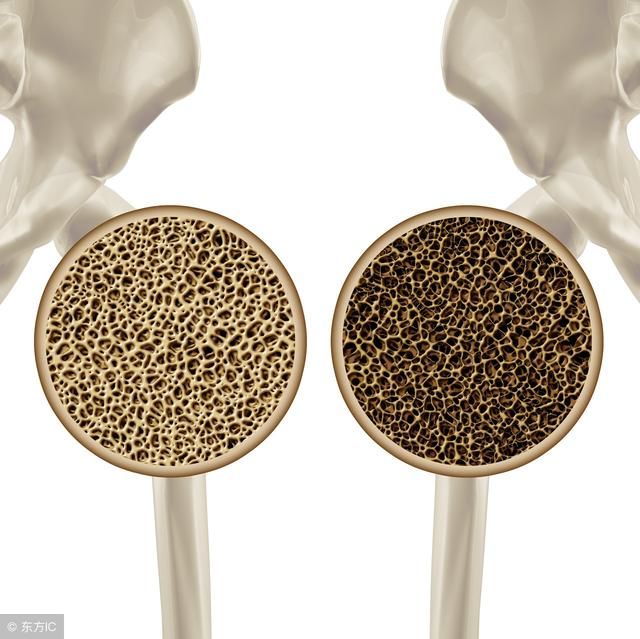 长期喝可乐雪碧等碳酸饮料,会对身体造成怎样