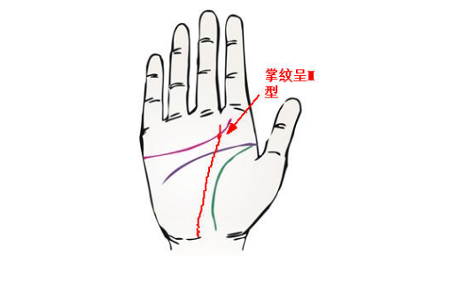 掌纹呈m型 掌纹呈m型,是指由事业线从手腕处向上延伸,与星橄哂胫腔