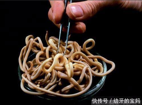 6岁女童饭前总闹肚子疼,吃完胃药也没用,医生