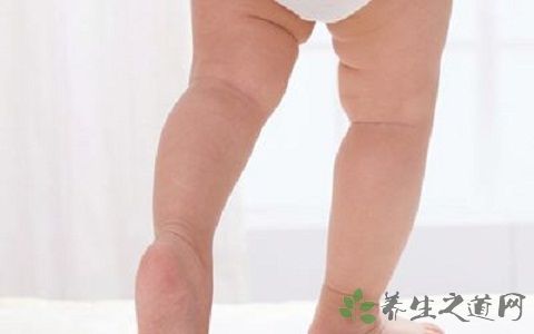 先天性髋关节脱位不能吃什么,先天性髋关节脱