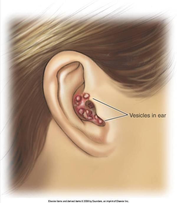 身上长了这条龙是疼痛难忍 要是长在这里更是