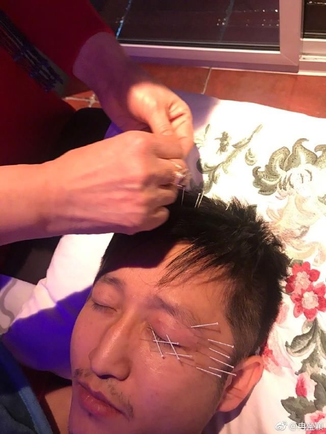 冉莹颖发邹市明治疗照片,满脸扎满针针扎心,网友:拳王早日康复
