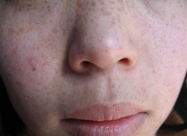 药店里很便宜的药,用来敷脸美白祛斑,斑点细纹