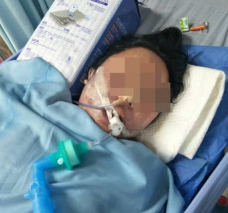 女子1天连做3项整形手术 次日陷入昏迷6天后身亡