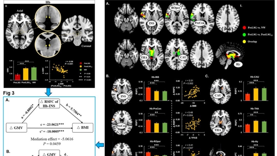 肥胖潜在成因研究取得新进展 肥胖潜在成因研究取得新进展