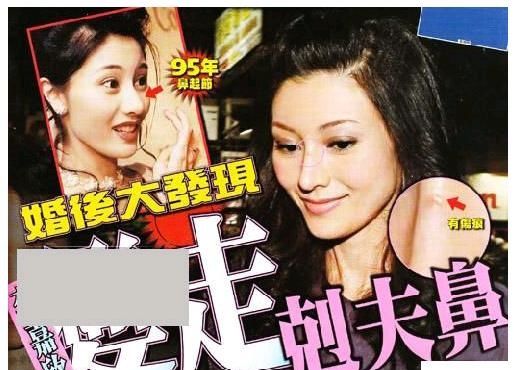 李嘉欣与老公被偶遇,整容后遗症吓人!网友:因面