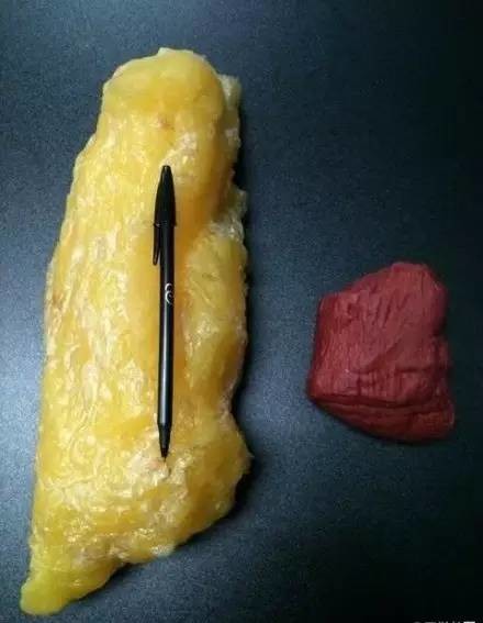 健康丨体重一样,为何你显胖?看完吓一跳