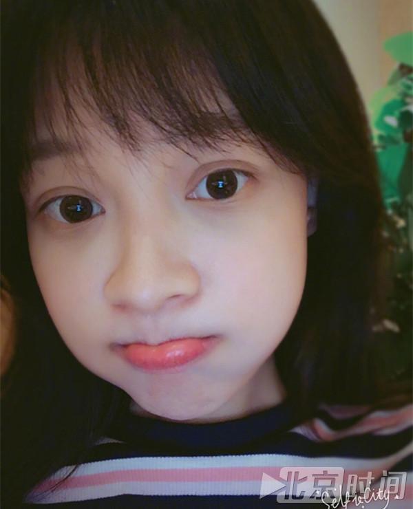 孙怡晒纯素颜照,这双眼皮是不是割过?