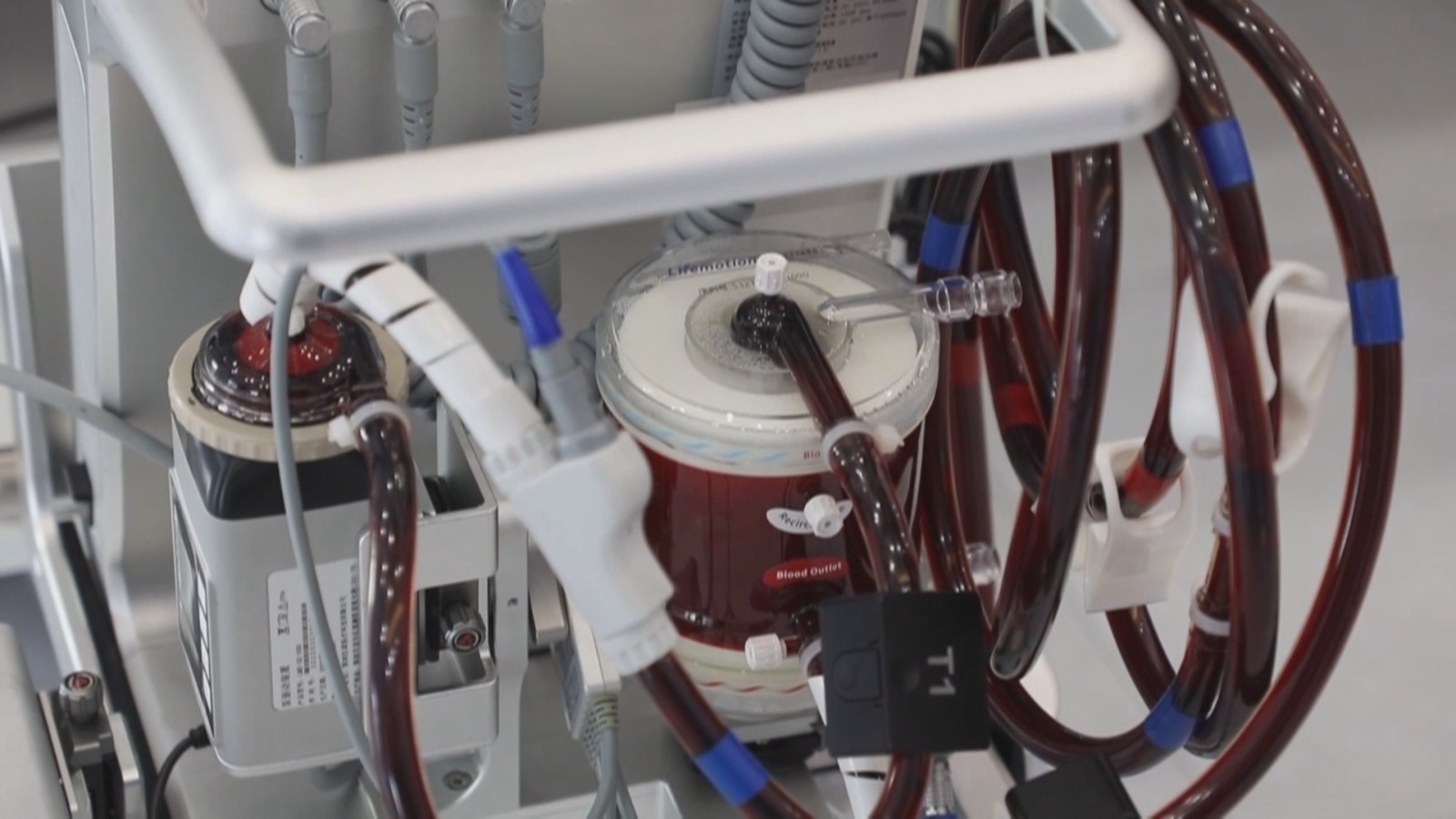 我国国产体外膜肺氧合治疗(ECMO)产品获批上市 我国国产体外膜肺氧合治疗(ECMO)产品获批上市