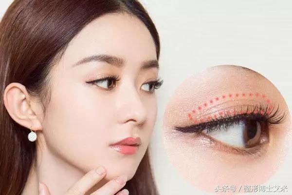 热巴杨幂赵丽颖…细数被双眼皮贴坑过的明星们