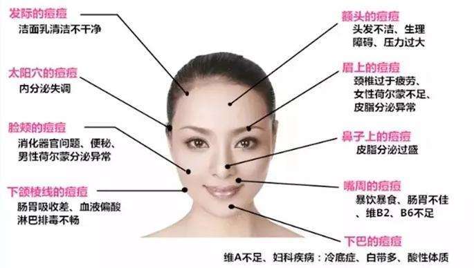 脸部不同部位的皮肤不断长痘的原因是什么?怎