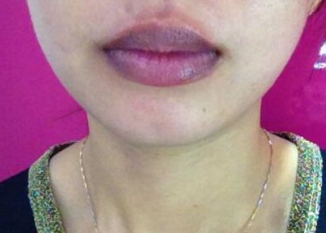 嘴唇发紫的原因是什么?嘴唇的颜色可预示你身