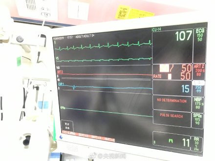 本来这时候，医院已经可以宣布病人死亡了，可是医生们不愿意放弃这名病人。医生用医学仪器完全代替了病人身体内各个器官的工作，就这么静静等待病人的苏醒，可是随着时间的流逝，病人并没有什么反应。