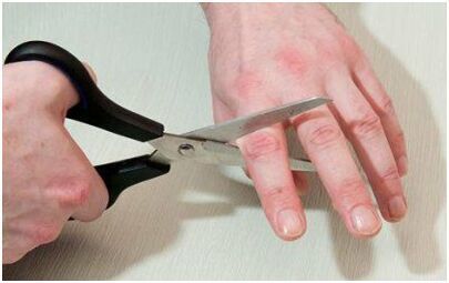 俄一男子为让警察调查其妻被强奸案切断手指 俄一男子为让警察调查其妻被强奸案切断手指